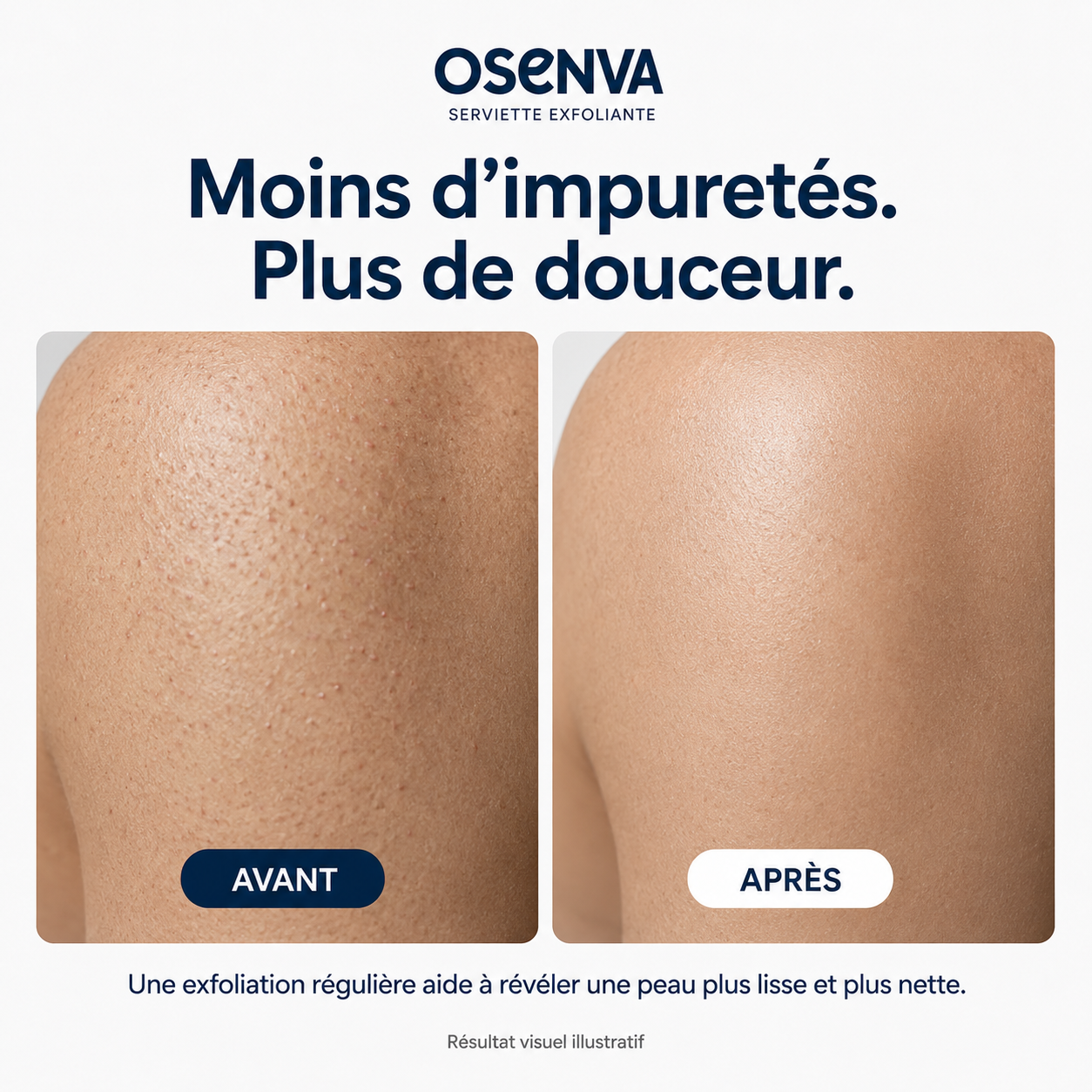 Serviette Exfoliante Corps Osenva®